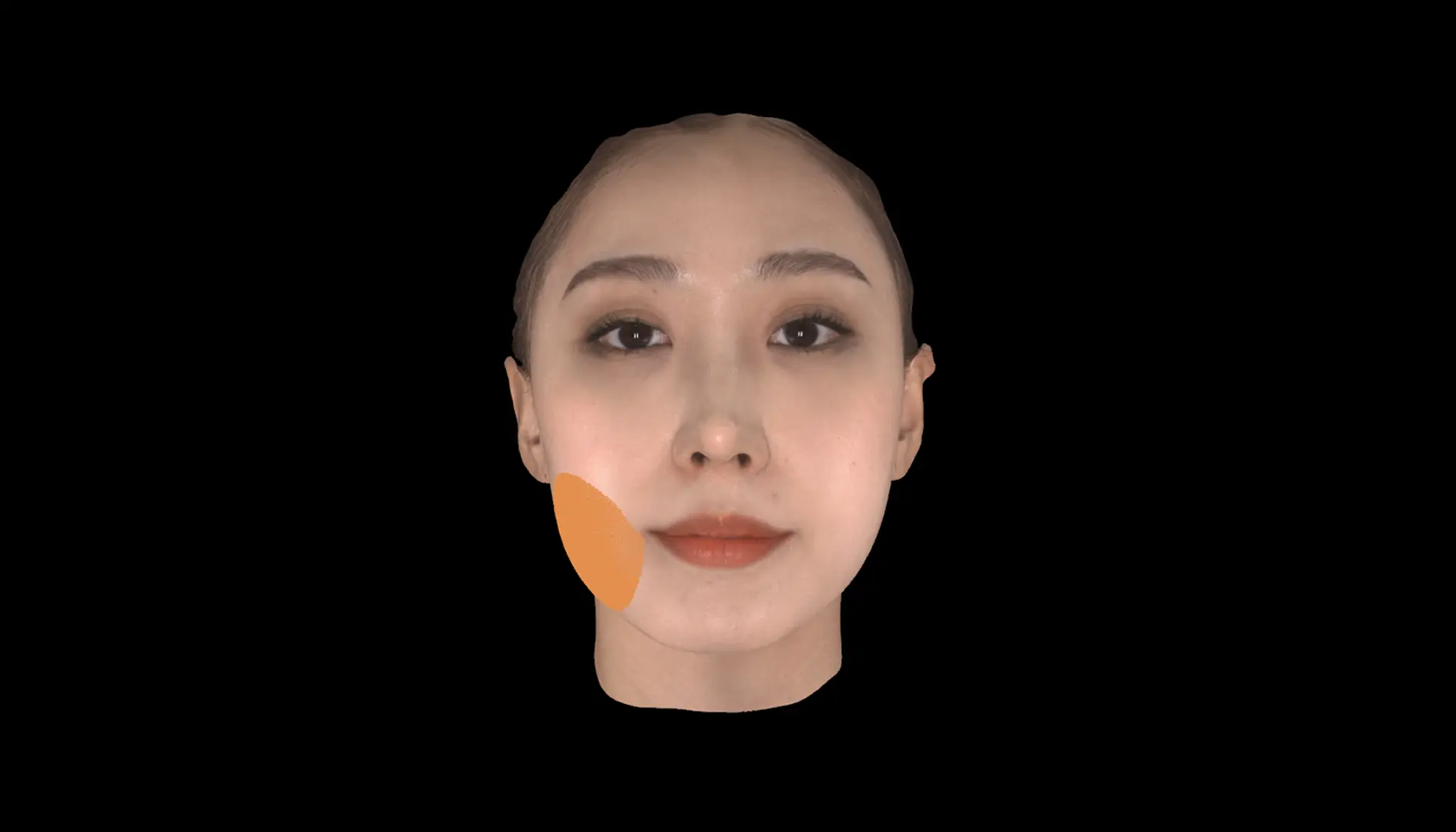 연조직
