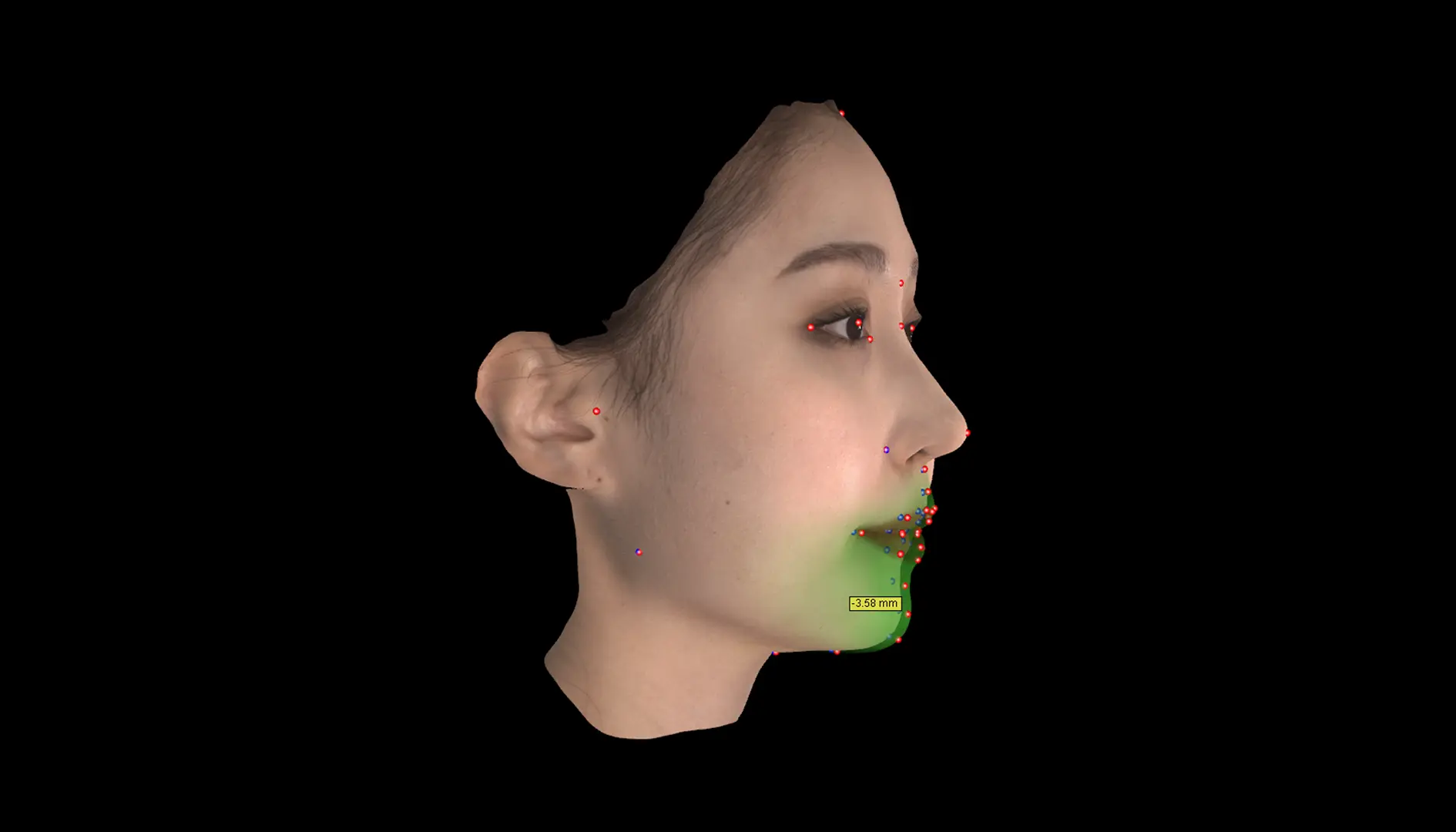 중첩 (3D & 2D)